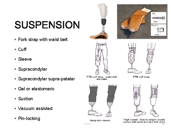 § Fork strap with waist belt § Cuff § Sleeve § Supracondylar supra-patelar §