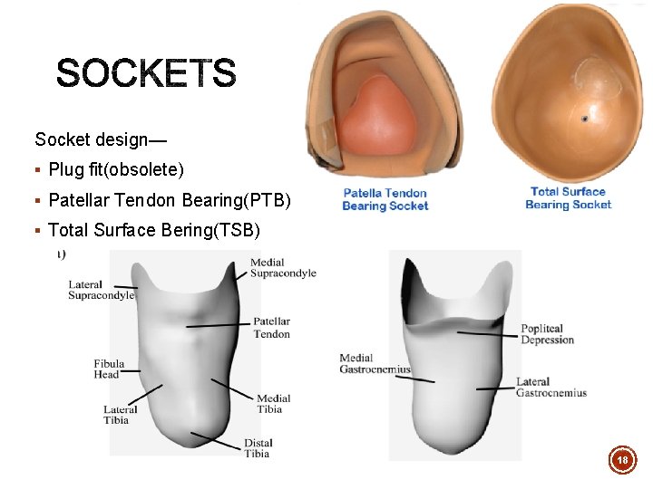 Socket design— § Plug fit(obsolete) § Patellar Tendon Bearing(PTB) § Total Surface Bering(TSB) 18