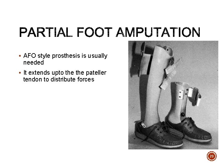 § AFO style prosthesis is usually needed § It extends upto the pateller tendon