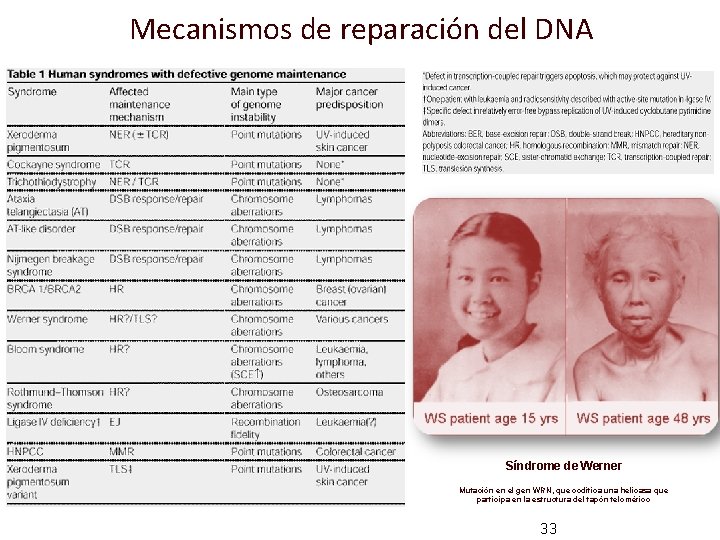 Mecanismos de reparación del DNA Síndrome de Werner Mutación en el gen WRN, que