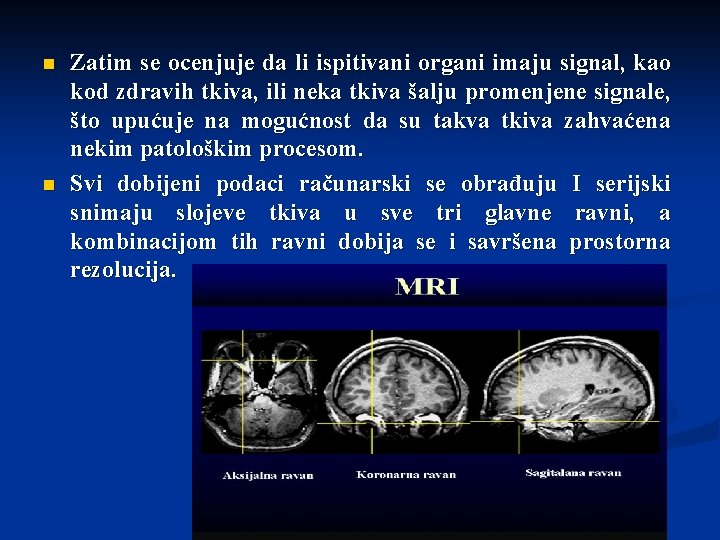 n n Zatim se ocenjuje da li ispitivani organi imaju signal, kao kod zdravih