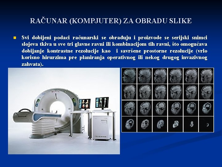 RAČUNAR (KOMPJUTER) ZA OBRADU SLIKE n Svi dobijeni podaci računarski se obrađuju i proizvode