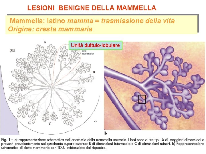 LESIONI BENIGNE DELLA MAMMELLA Mammella: latino mamma = trasmissione della vita Origine: cresta mammaria