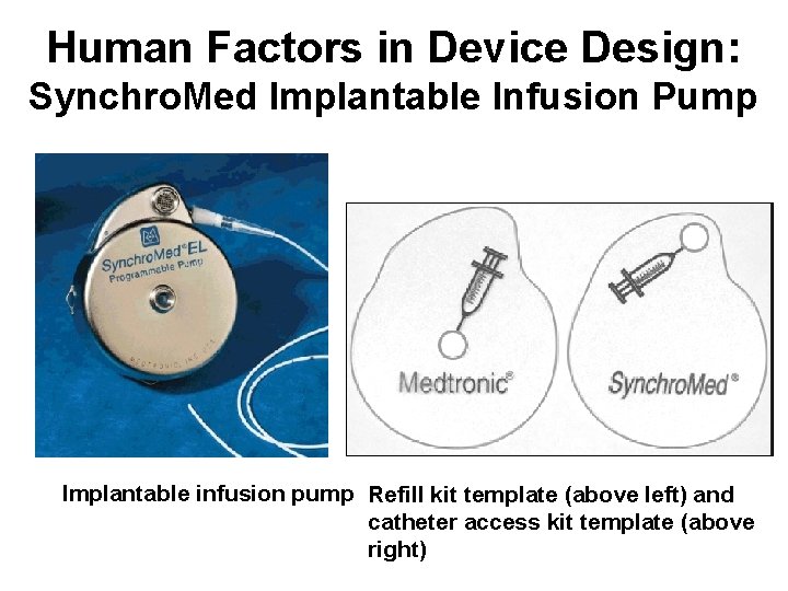 Human Factors in Device Design: Synchro. Med Implantable Infusion Pump Implantable infusion pump Refill
