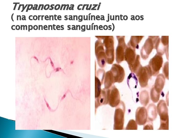 Trypanosoma cruzi ( na corrente sanguínea junto aos componentes sanguíneos) 