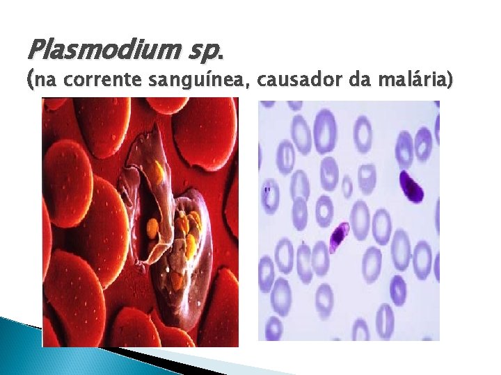 Plasmodium sp. (na corrente sanguínea, causador da malária) 