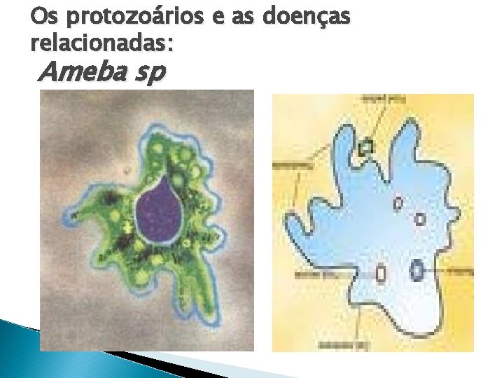 Os protozoários e as doenças relacionadas: Ameba sp 