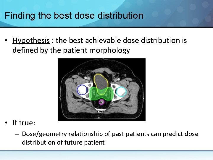 Finding the best dose distribution • Hypothesis : the best achievable dose distribution is