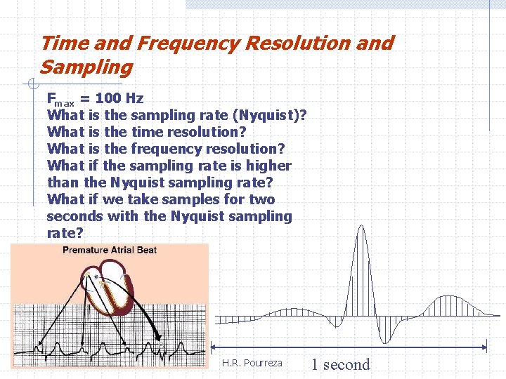 Time and Frequency Resolution and Sampling Fmax = 100 Hz What is the sampling