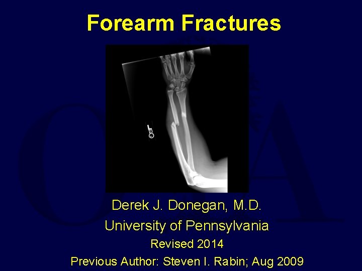 Forearm Fractures Derek J. Donegan, M. D. University of Pennsylvania Revised 2014 Previous Author: