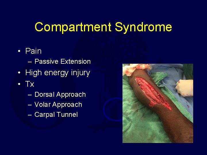 Compartment Syndrome • Pain – Passive Extension • High energy injury • Tx –