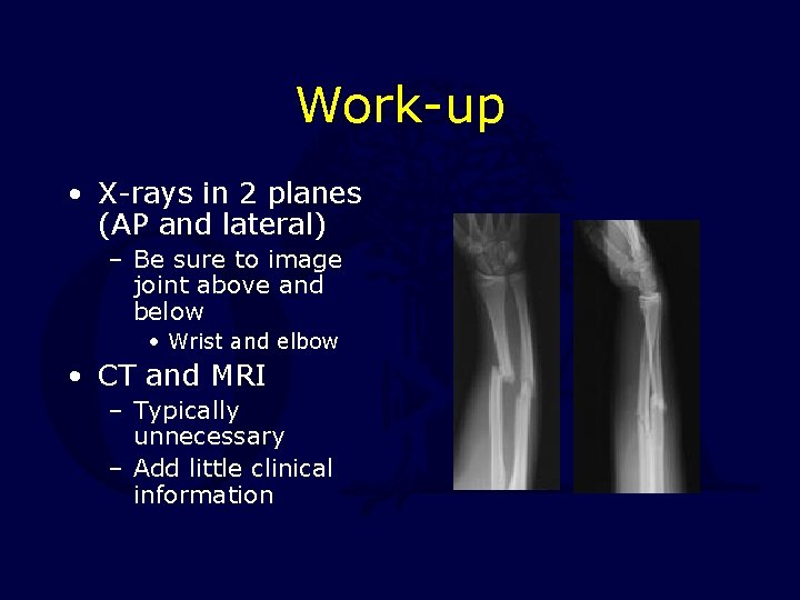 Work-up • X-rays in 2 planes (AP and lateral) – Be sure to image