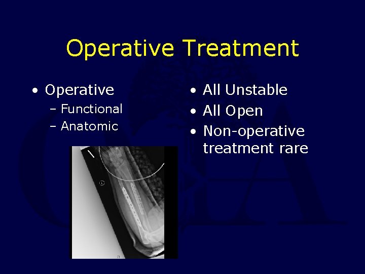 Operative Treatment • Operative – Functional – Anatomic • All Unstable • All Open