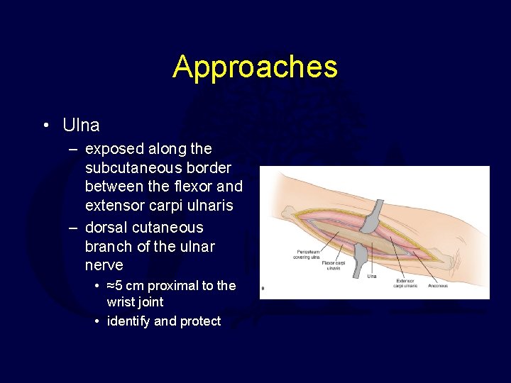 Approaches • Ulna – exposed along the subcutaneous border between the flexor and extensor