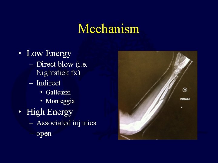 Mechanism • Low Energy – Direct blow (i. e. Nightstick fx) – Indirect •