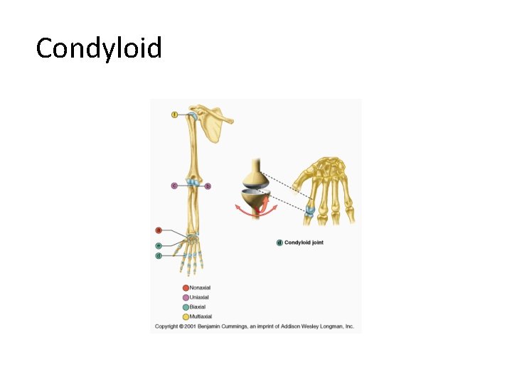 Condyloid 
