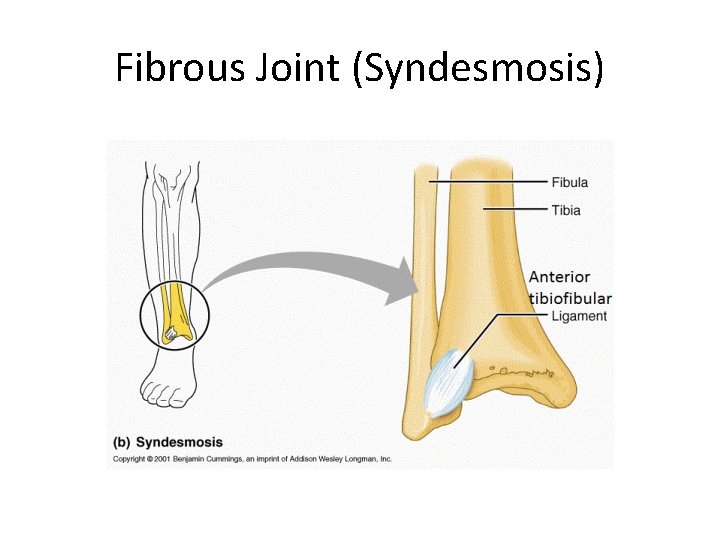 Fibrous Joint (Syndesmosis) 