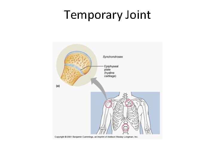 Temporary Joint 