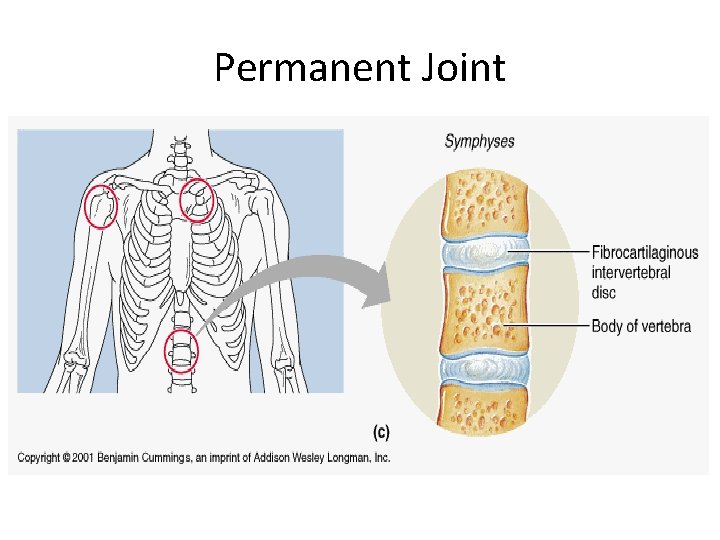 Permanent Joint 