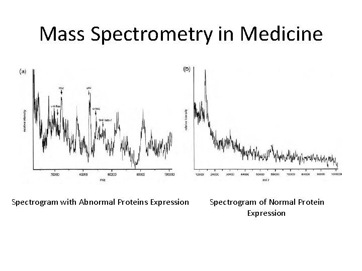 Mass Spectrometry in Medicine Spectrogram with Abnormal Proteins Expression Spectrogram of Normal Protein Expression