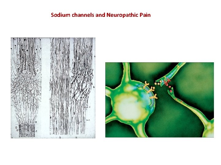 Sodium channels and Neuropathic Pain 
