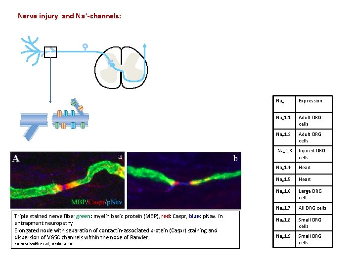 Nerve injury and Na+-channels: Triple stained nerve fiber green: myelin basic protein (MBP), red: