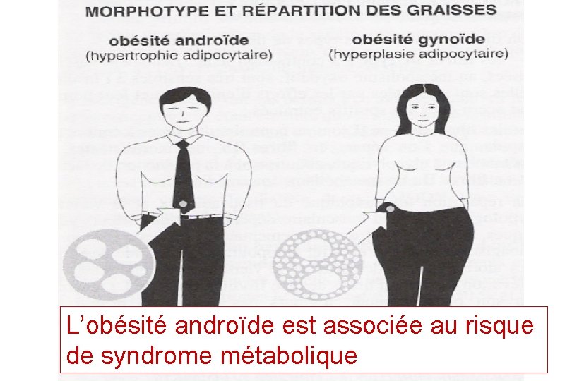 L’obésité androïde est associée au risque de syndrome métabolique L’obésité androïde est associée au risque de syndrome métabolique
