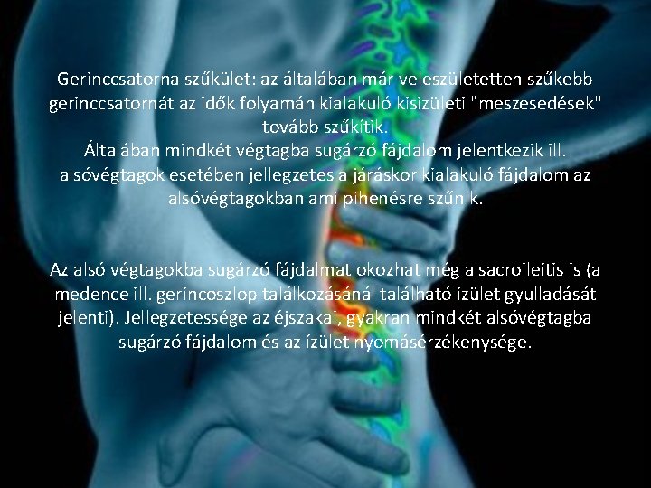 Gerinccsatorna szűkület: az általában már veleszületetten szűkebb gerinccsatornát az idők folyamán kialakuló kisizületi "meszesedések"