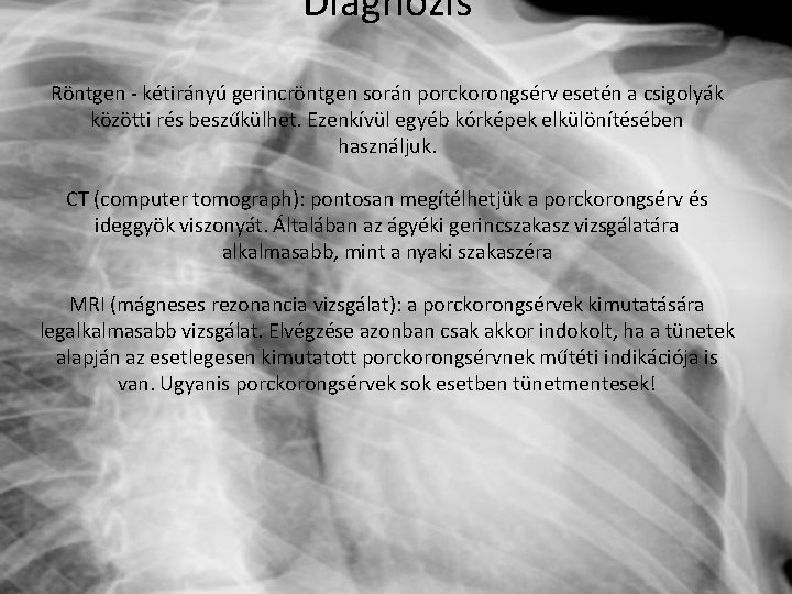 Diagnózis Röntgen - kétirányú gerincröntgen során porckorongsérv esetén a csigolyák közötti rés beszűkülhet. Ezenkívül