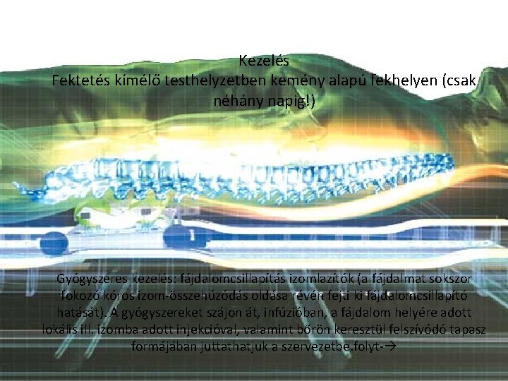 Kezelés Fektetés kímélő testhelyzetben kemény alapú fekhelyen (csak néhány napig!) Gyógyszeres kezelés: fájdalomcsillapítás izomlazítók