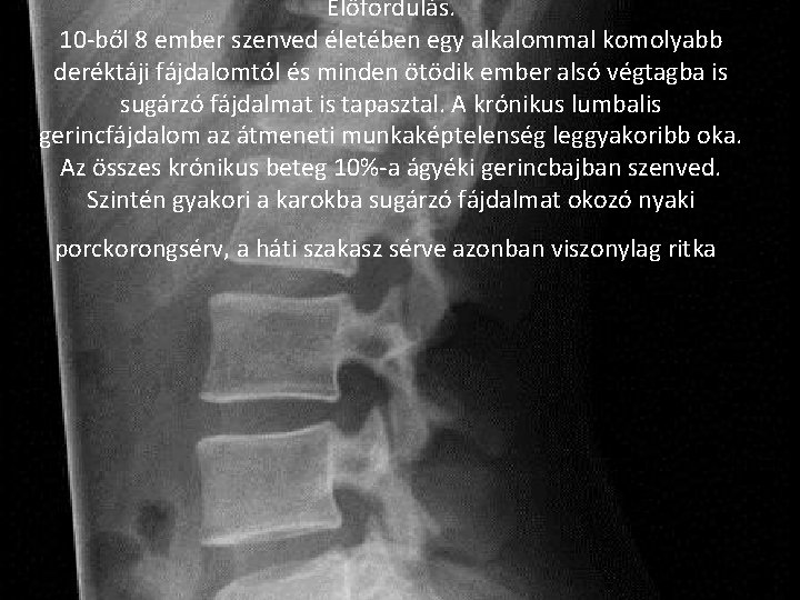 Előfordulás. 10 -ből 8 ember szenved életében egy alkalommal komolyabb deréktáji fájdalomtól és minden