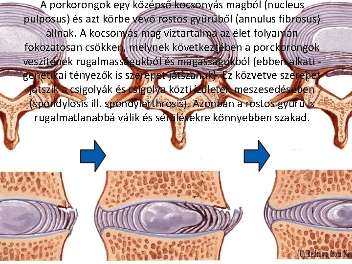 A porkorongok egy középső kocsonyás magból (nucleus pulposus) és azt körbe vevő rostos gyűrűből