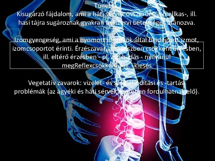 Tünetek. Kisugárzó fájdalom, ami a háti sérvek övszerűen a mellkas-, ill. hasi tájra sugároznak
