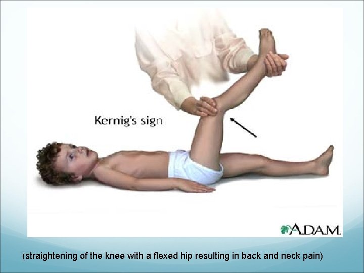 (straightening of the knee with a flexed hip resulting in back and neck pain)
