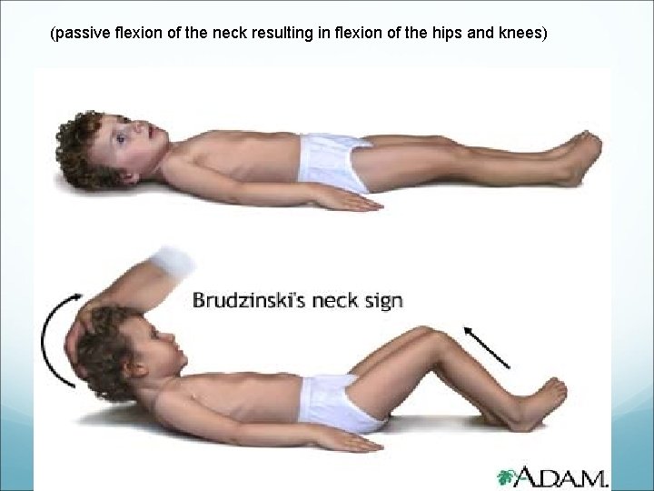 (passive flexion of the neck resulting in flexion of the hips and knees) 