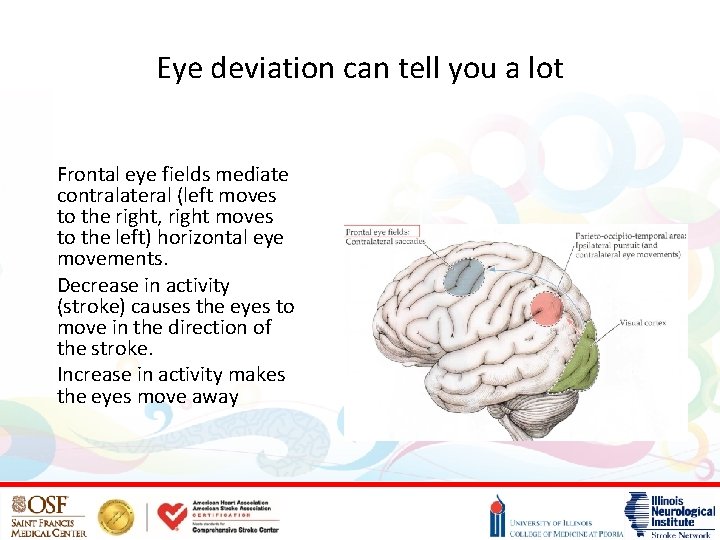 Eye deviation can tell you a lot Frontal eye fields mediate contralateral (left moves