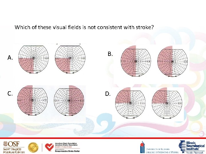 Which of these visual fields is not consistent with stroke? A. C. B. D.