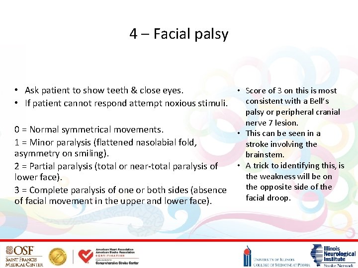 4 – Facial palsy • Ask patient to show teeth & close eyes. •