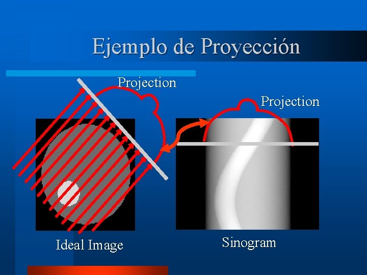 Ejemplo de Proyección Projection Ideal Image Sinogram 