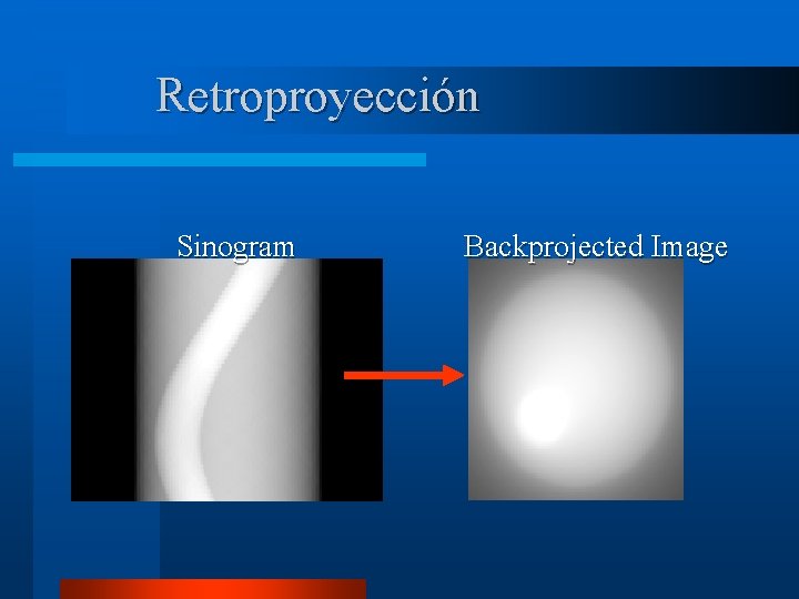 Retroproyección Sinogram Backprojected Image 