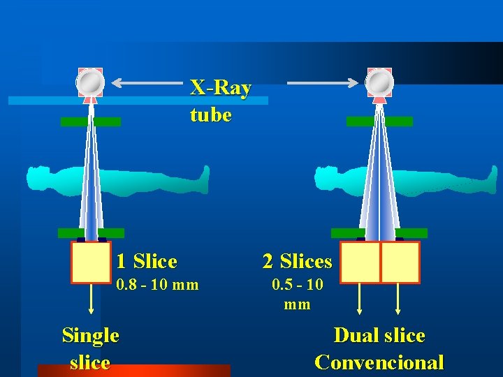 X-Ray tube 1 Slice 0. 8 - 10 mm Single slice 2 Slices 0.