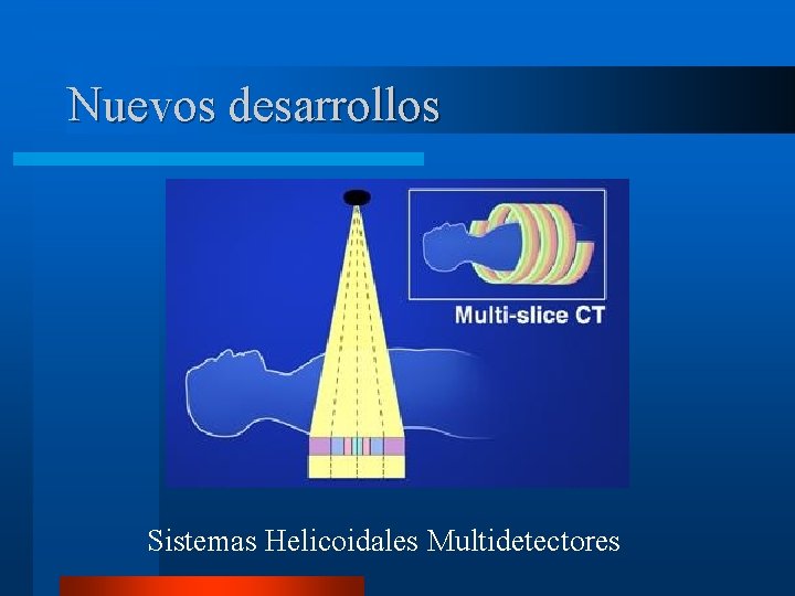 Nuevos desarrollos Sistemas Helicoidales Multidetectores 