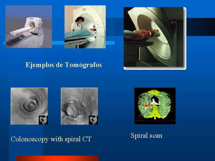 Ejemplos de Tomógrafos Colonoscopy with spiral CT Spiral scan 