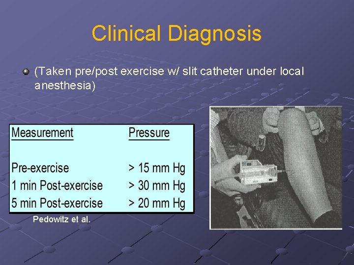 Clinical Diagnosis (Taken pre/post exercise w/ slit catheter under local anesthesia) Pedowitz et al.