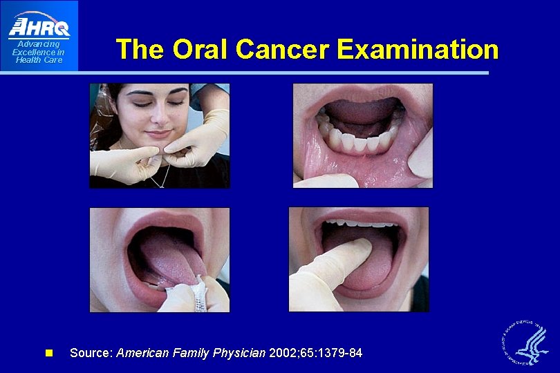Advancing Excellence in Health Care n The Oral Cancer Examination Source: American Family Physician Advancing Excellence in Health Care n The Oral Cancer Examination Source: American Family Physician