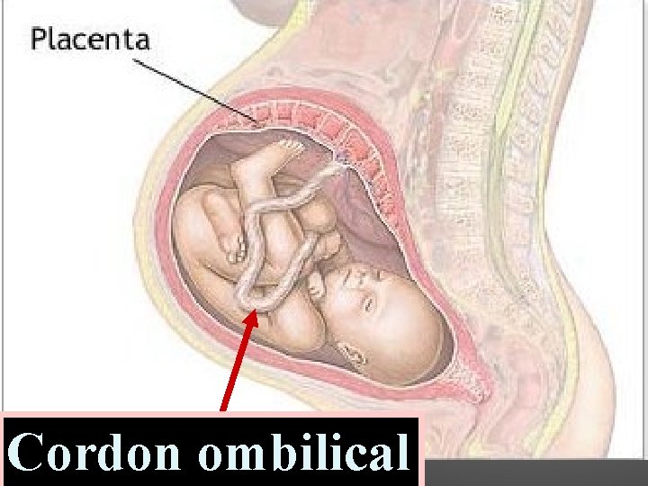 Cordon ombilical 