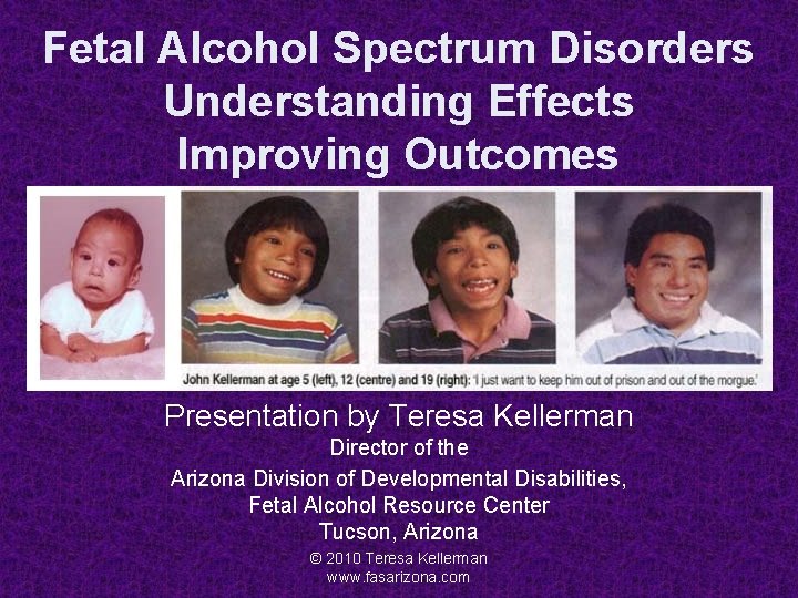 Fetal Alcohol Spectrum Disorders Understanding Effects Improving Outcomes Presentation by Teresa Kellerman Director of