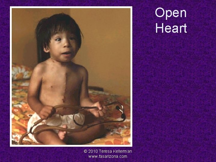 Open Heart © 2010 Teresa Kellerman www. fasarizona. com 