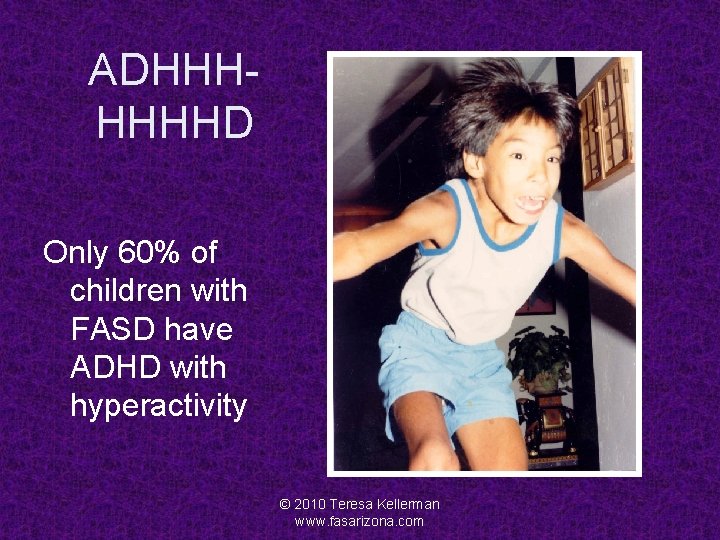 ADHHHHHHHD Only 60% of children with FASD have ADHD with hyperactivity © 2010 Teresa