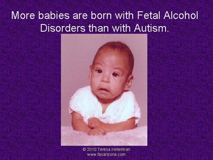 More babies are born with Fetal Alcohol Disorders than with Autism. © 2010 Teresa